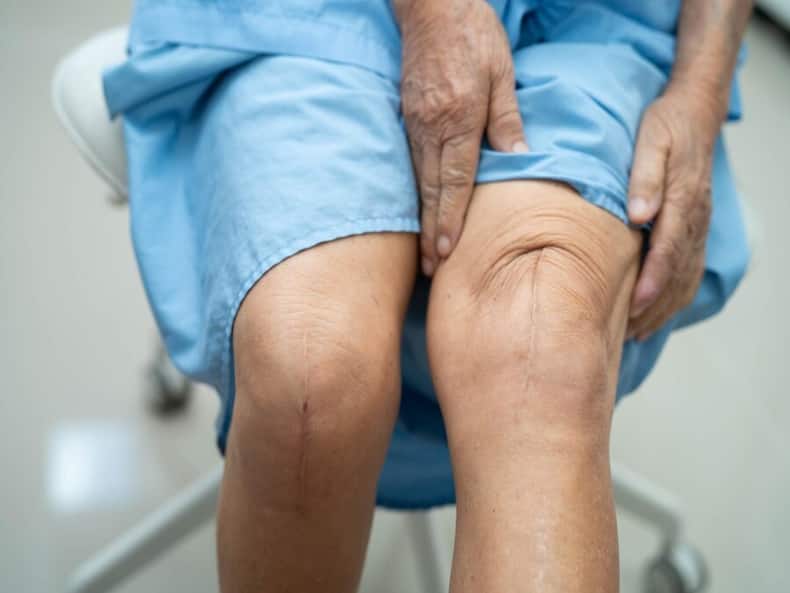 7 Misconceptions About Knee Pain And Joint Replacement Surgery That You Must Know About