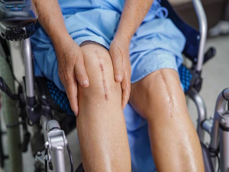 7 Misconceptions About Knee Pain And Joint Replacement Surgery That You Must Know About