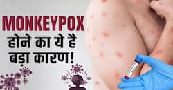 Monkeypox Symptoms: ये हैं मॉनकीपॉक्स के लक्षण! जानें बचाव का तरीक़ा