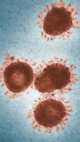 Mpox Virus Prevention Measures: 6 Tips To Protect Yourself From Deadly Mpox Virus Mpox Virus Prevention Measures: 6 Tips To Protect Yourself From Deadly Mpox Virus