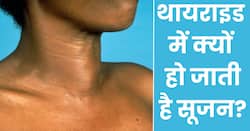 इस कारण से थायराइड रोगियों को हो जाती है सूजन, कम करने के लिए अपनाएं आसान से नुस्खे