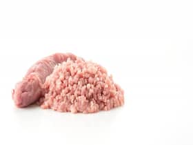 Doctor Shares Strange Image Of Person's Legs Infected With Parasitic Infection From Eating Undercooked Meat Doctor Shares Strange Image Of Person's Legs Infected With Parasitic Infection From Eating Undercooked Meat