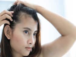 What Are The Top 6 Causes Of Receding Hairline In Women?