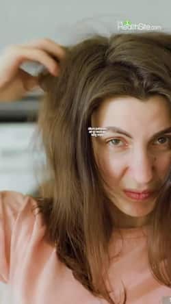 Home Remedies for Itchy Scalp