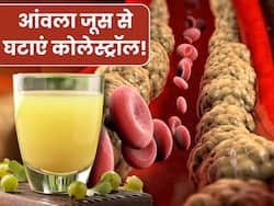 बैड कोलेस्ट्रॉल में अमृत है आंवला का जूस, इस तरह सेवन करने से नस-नस में जमा Cholesterol हो जाएगा बाहर