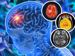 Can Smartphones Cause Brain Cancer? Explains Radiation Oncologist