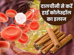 नसों में जमे बैड कोलेस्ट्रॉल को खत्म करेगी दालचीनी, रोजाना इन 2 तरीकों से करें सेवन