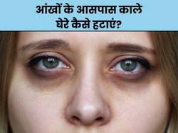 आंखों के आसपास काले घेरे से चेहरा हो जाता है खराब, इन 3 नुस्खों में से 1 नुस्खा जरूर होगा असरदार