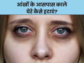 आंखों के आसपास काले घेरे से चेहरा हो जाता है खराब, इन 3 नुस्खों में से 1 नुस्खा जरूर होगा असरदार