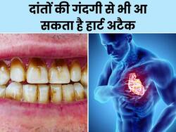दांतों की गंदगी से भी आ सकता है हार्ट अटैक, एक्सपर्ट से जानें क्या है बचाव के उपाय