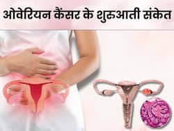 ओवेरियन कैंसर की शुरुआत होने पर शरीर देता है ये 5 संकेत, 90 फीसदी महिलाएं साधारण समझकर करती हैं इग्नोर