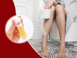 Excessive Foamy Urine At Night: 5 Potential Diseases That Can Cause Frothy Urination