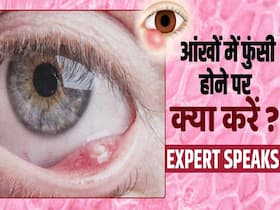 Eye Infection Prevention: बरसात के मौसम में आंखों में होती है ये दर्दनाक समस्या! जानें इसका इलाज Eye Infection Prevention: बरसात के मौसम में आंखों में होती है ये दर्दनाक समस्या! जानें इसका इलाज
