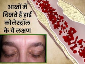 कोलेस्ट्रॉल बढ़ने पर आंखों के आसपास नजर आते हैं ये 4 लक्षण, 90 फीसदी लोग साधारण समझकर करते हैं इग्नोर