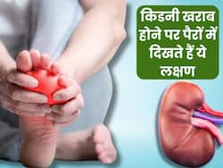किडनी खराब होने पर पर पैरों के आसपास दिखते हैं ये 3 लक्षण, ज्यादातर लोग साधारण समझकर करते हैं इग्नोर