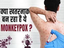 मंकीपॉक्स के बढ़ रहे हैं मामले, जानें बचाव का तरीक़ा!