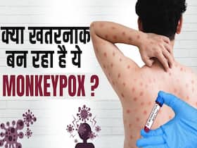 मंकीपॉक्स के बढ़ रहे हैं मामले, जानें बचाव का तरीक़ा!