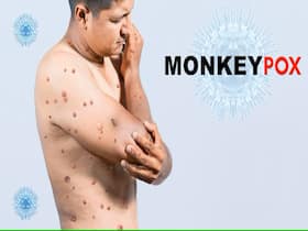 Mpox Global Outbreak: WHO Grants Approval To First Vaccine In Their Fight Against The Disease