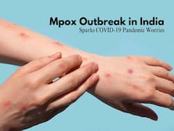 Mpox Alert: India Confirms First Monkeypox Case, Echoes COVID-19 Concerns
