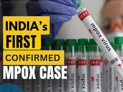Monkeypox Enters India: Government Confirms First Mpox Case; No Immediate Risk To Public, Says Centre