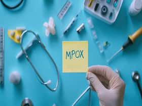Kerala Confirms Second Mpox Infection From Ernakulam: 4 Things You Must Not Do As Per Government Advisory Kerala Confirms Second Mpox Infection From Ernakulam: 4 Things You Must Not Do As Per Government Advisory