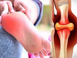 Uric Acid Lowering Diet Hack: 5 Ayurvedic Drinks To Lower Uric Acid Levels Instantly