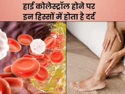 कोलेस्ट्रॉल बढ़ने पर शरीर के इन 3 हिस्सों में होने लगता है दर्द, संकेत पहचानकर करवाएं अपना इलाज
