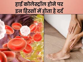 कोलेस्ट्रॉल बढ़ने पर शरीर के इन 3 हिस्सों में होने लगता है दर्द, संकेत पहचानकर करवाएं अपना इलाज