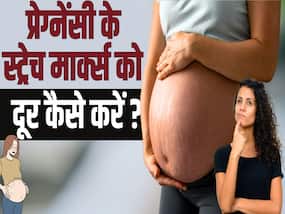 Stretch Mark Removal Tips: इन तरीकों से स्ट्रेच मार्क्स से मिलेगा छूटकारा, देखें ये वीडियो