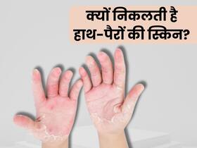 इन 5 कारणों से निकलने लगती हैं हाथ-पैरों की स्किन, अधिकतर लोग करते हैं इग्नोर