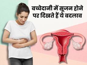 बच्चेदानी में सूजन होने पर शरीर में दिखते हैं ये 5 बदलाव, ज्यादातर महिलाएं साधारण सझकर करती हैं इग्नोर