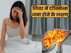 लिवर में टॉक्सिन्स जमा होने पर शरीर देता है ये 3 संकेत, 90 फीसदी लोग साधारण समझकर करते हैं इग्नोर लिवर में टॉक्सिन्स जमा होने पर शरीर देता है ये 3 संकेत, 90 फीसदी लोग साधारण समझकर करते हैं इग्नोर