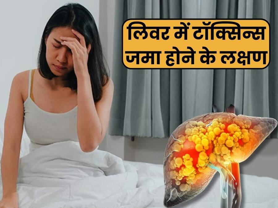 Liver Me Toxin Jama Hone Ke Lakshan लिवर में टॉक्सिन्स जमा होने पर