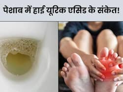 यूरिक एसिड बढ़ने पर पेशाब में दिखते हैं 4 संकेत, 90 फीसदी लोग साधारण समझकर करते हैं इग्नोर