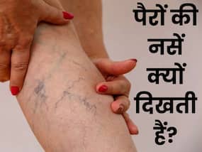 पैरों की नसों दिखने के पीछे हो सकती हैं ये 5 वजह, अधिकतर लोग करते हैं इग्नोर