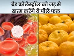 हाई कोलेस्ट्रॉल के दुश्मन हैं ये 5 पीले फल, नसों में जमा बैड कोलेस्ट्रॉल को खींचकर निकाल फेंकेंगे बाहर