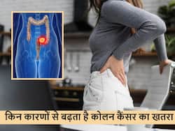 Colon cancer: दिनचर्या में अक्सर की जाने वाली ये गलतियां बन सकती हैं कोलन कैंसर का कारण