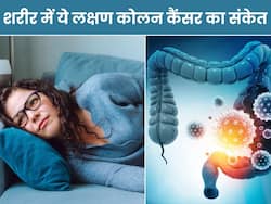 शरीर में दिखने वाले ये 5 सामान्य लक्षण हो सकते हैं कोलन कैंसर का संकेत, इग्नोर करने की गलती न करें