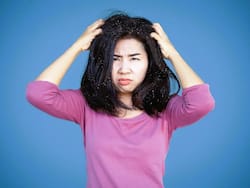 सिर में खुजली और डैंड्रफ से हैं परेशान तो इन हरी पत्तियों से करें इलाज, जानें इस्तेमाल का तरीका