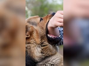 कुत्ते के काटने पर करें ये 9 घरेलू उपचार
