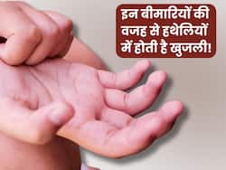 हथेली में बार-बार खुजली होना इन 5 बीमारियों की ओर देता है संकेत, तुंरत कराएं इलाज