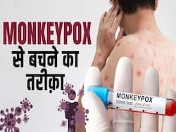 मंकीपॉक्स में गलती से भी ना लें ये दवाई, देखें ये वीडियो