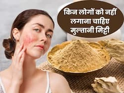 इन लोगों को गलती से भी नहीं लगानी चाहिए मुल्तानी मिट्टी, हो सकती हैं कई स्किन प्रॉब्लम्स