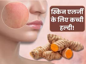 स्किन एलर्जी के लिए जरूरी नहीं महंगी दवाएं सिर्फ कच्ची हल्दी से भी मिलेगी राहत, जानें इसके फायदे