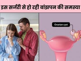 Ovarian cyst की सर्जरी से प्रजनन क्षमता हो सकती है प्रभावित? डॉक्टर ने दी सही जानकारी