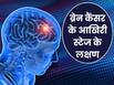 ब्रेन कैंसर के आखिरी स्टेज में शरीर देता है ये 5 संकेत, लक्षणों की पहचानकर तुरंत कराएं इलाज