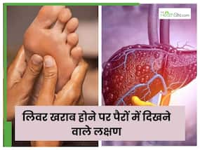 ल‍िवर खराब होने पर पैरों में द‍िखते हैं ये लक्षण, एड़िया भी लगती हैं फटने