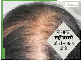बालों के साथ ये 10 गल‍ियां न करें, वरना स‍िर नहीं फर्श पर द‍िखेंगे बाल
