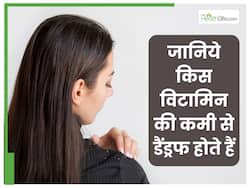 क‍िस व‍िटाम‍िन की कमी से स‍िर में डैंड्रफ होता है?