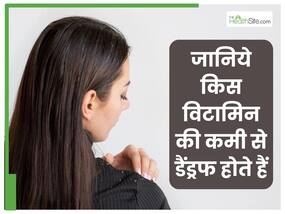 क‍िस व‍िटाम‍िन की कमी से स‍िर में डैंड्रफ होता है?